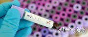 فرم تهاجمی ویروس ایدز در کوبا