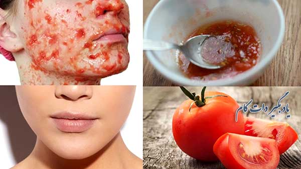 اثرات شگفت انگیز گوجه فرنگی برای پوست