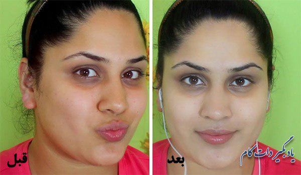 قبل و بعد از مصرف سفید کننده مناسب پوست
