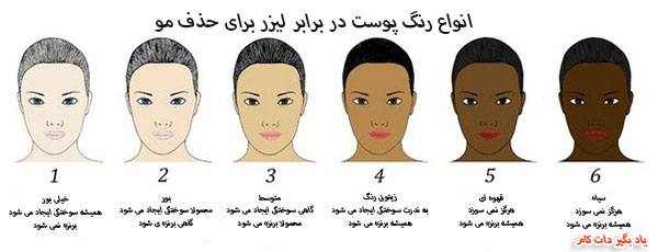 انواع رنگ پوست در برابر لیزر حذف مو
